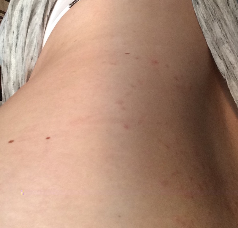 Bauch Seite